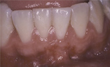 case 1 after
