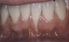 case 1 before