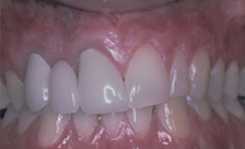 case 2 after