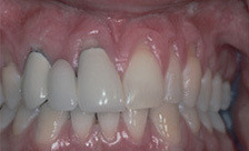 case 2 before