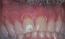 case 3 before